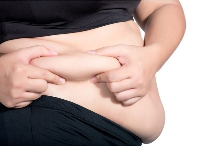 La liposuccion peut traiter l’obésité : vrai ou faux ?