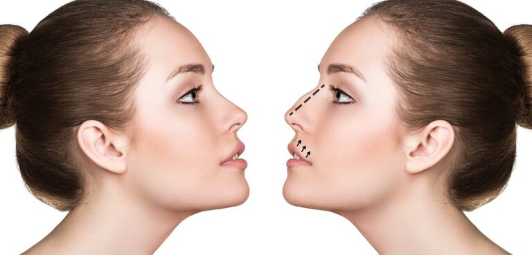 Rhinoplastie en Tunisie ou en Turquie : comparatif des destinations de chirurgie esthétique