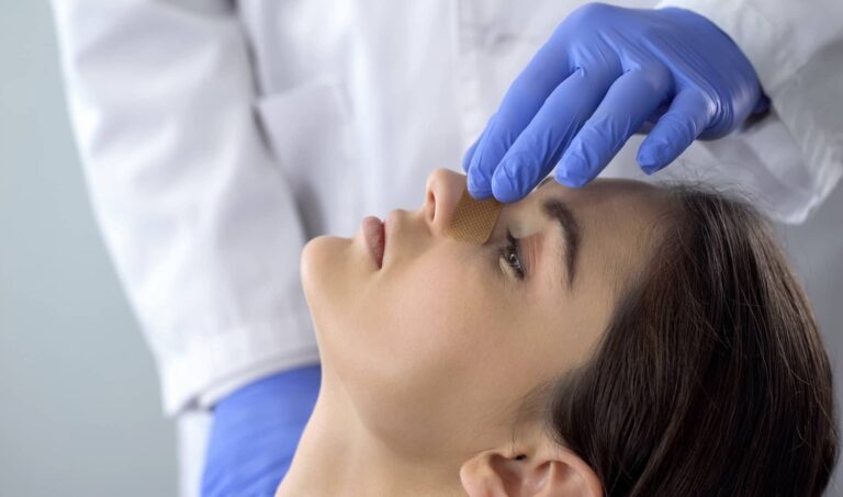 Quel est le tarif d’une rhinoplastie secondaire en France ?