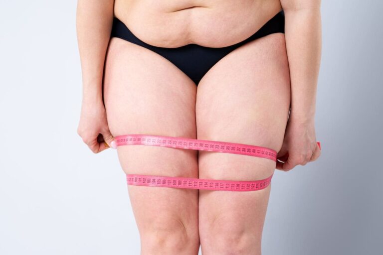 Jambes poteaux : symptômes, causes et chirurgie pour correction