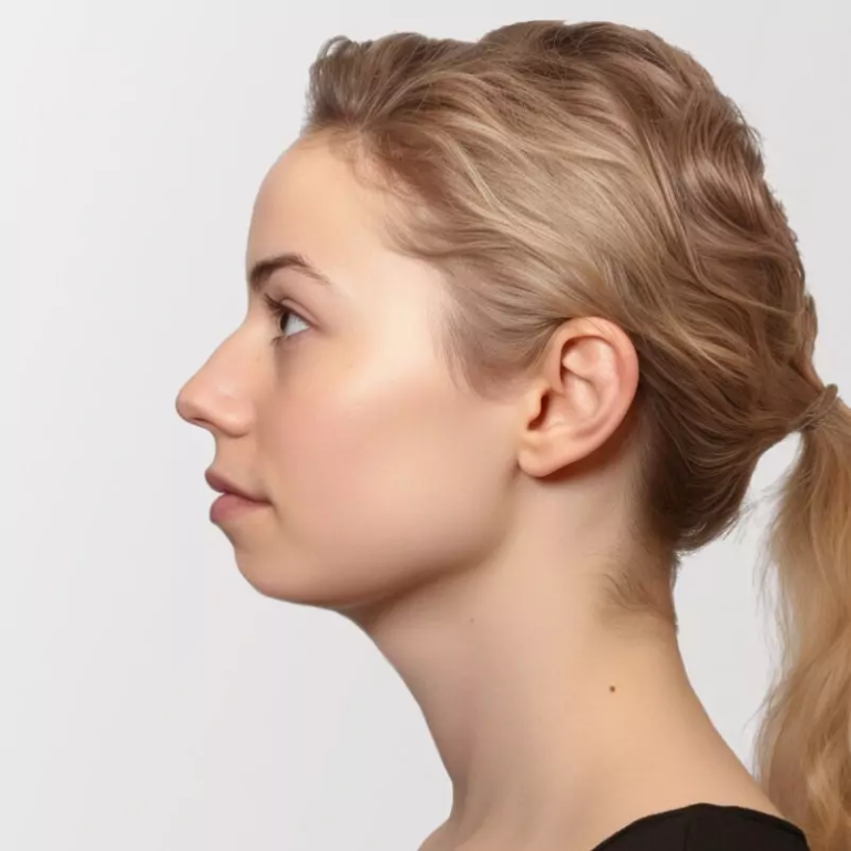 Menton fuyant : tout savoir sur les causes et traitements