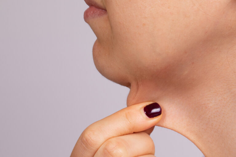 La Chirurgie Esthétique pour Traiter le Cou de Dindon