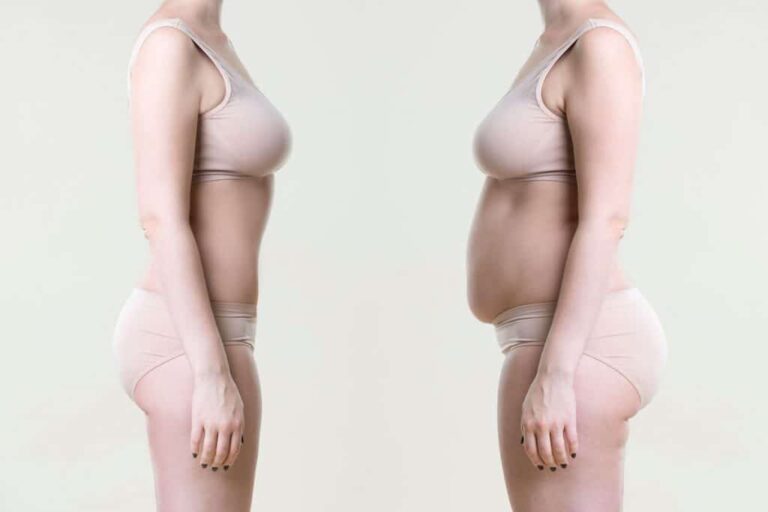 Liposuccion complète en Turquie : Les Avantages