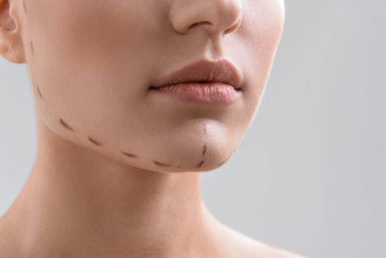 Chirurgie plastique prothèse menton en France