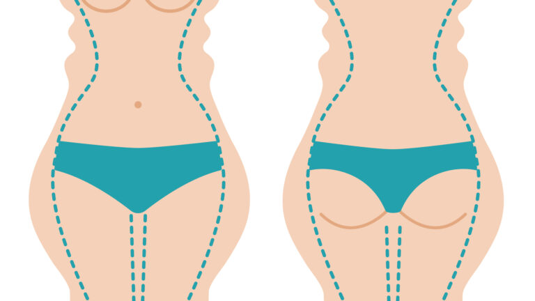 Tarif Liposuccion Cuisses et Hanches en Turquie: Prix et Informations Utiles