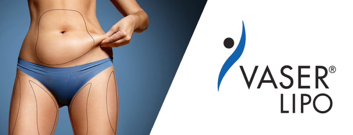 vaser lipo tunisie