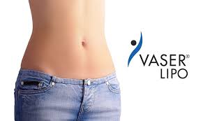 vaserlipo tunisie vaser lipo tunisie