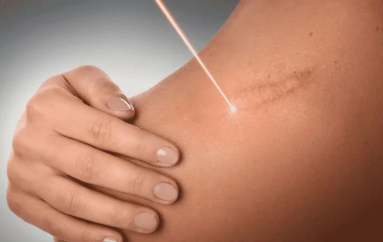 UrgoTouch : ses avantages, son déroulement, ses indications, …